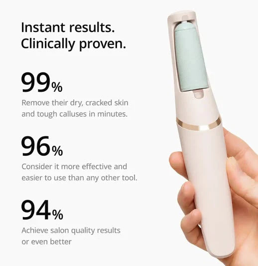 Ultimate Foot Care: Rechargeable Callus Remover and Skin Polisher